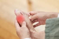 How Gout Progresses and Who Is at Risk