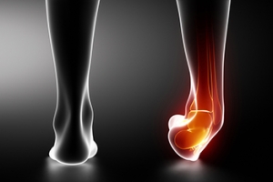 Methods to Prevent Ankle Sprains